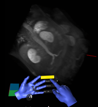 Medical 3D visualization system with gesture-based user interface