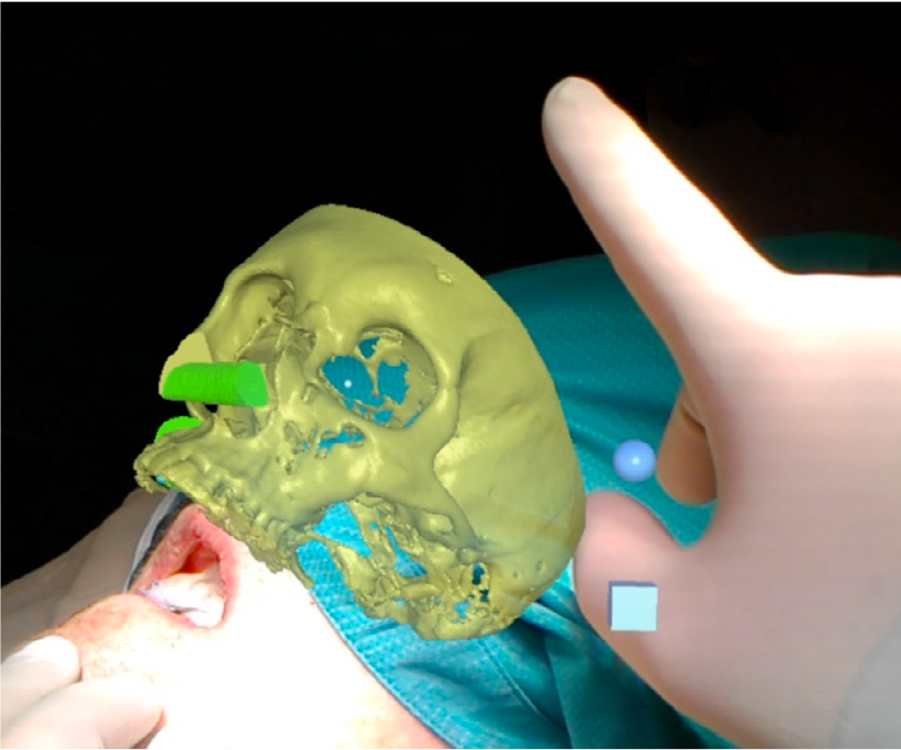 Augmented reality visualization for image-guided surgery: a validation study using a three-dimensional printed phantom