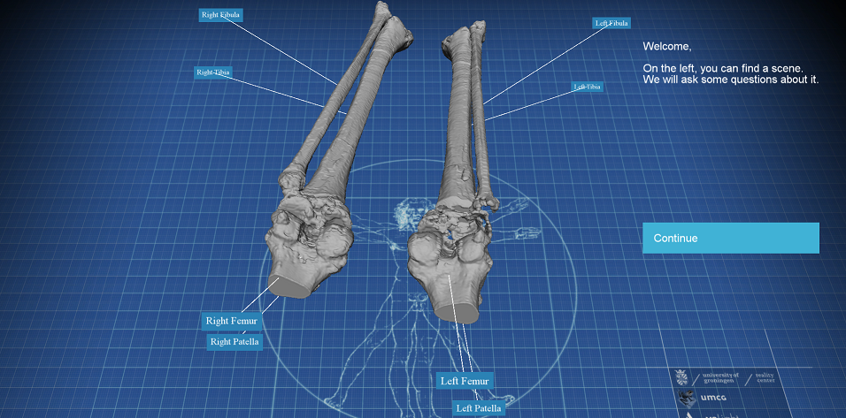 VeLight: A 3D Virtual Reality Tool for CT-based Anatomy Teaching and Training