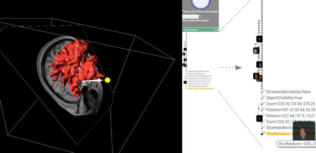 Improving Provenance Data Interaction for Visual Storytelling in Medical Imaging Data Exploration